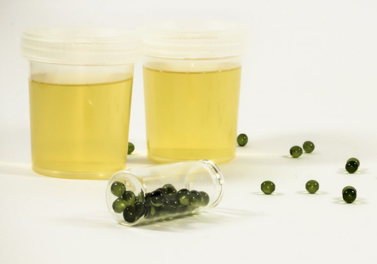 Vasos de orina